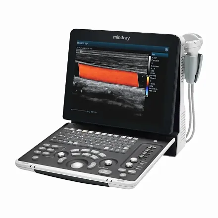 УЗИ аппарат Mindray Z60 Exp портативный