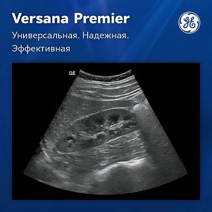 Клинические изображения Ультразвуковая система GE Versana Premier Platinum